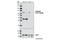 Lymphocyte Cytosolic Protein 1 antibody, 5277S, Cell Signaling Technology, Western Blot image 