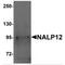 NLR Family Pyrin Domain Containing 12 antibody, MBS151244, MyBioSource, Western Blot image 
