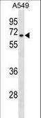 Hyaluronan Synthase 3 antibody, LS-B10150, Lifespan Biosciences, Western Blot image 