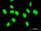Mixed Lineage Kinase Domain Like Pseudokinase antibody, H00197259-M02, Novus Biologicals, Immunocytochemistry image 