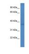 Fibronectin type 3 and ankyrin repeat domains protein 1 antibody, NBP1-69009, Novus Biologicals, Western Blot image 