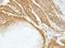 Heat Shock Protein Family A (Hsp70) Member 6 antibody, NBP1-32761, Novus Biologicals, Immunohistochemistry paraffin image 