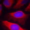 Inhibitor Of Nuclear Factor Kappa B Kinase Subunit Beta antibody, TA333219, Origene, Immunofluorescence image 