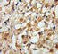 Myotubularin 1 antibody, A0255, ABclonal Technology, Immunohistochemistry paraffin image 
