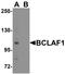 BCL2 Associated Transcription Factor 1 antibody, TA355007, Origene, Western Blot image 