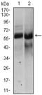 Hyaluronan Synthase 2 antibody, AM50088PU-N, Origene, Western Blot image 