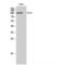 Ephrin type-A receptor 2 antibody, LS-C383369, Lifespan Biosciences, Western Blot image 