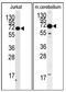 MeCP2 pS421 antibody, AP12280PU-N, Origene, Western Blot image 