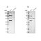 Chromosome 1 Open Reading Frame 116 antibody, PA5-52868, Invitrogen Antibodies, Western Blot image 