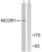 Nuclear receptor corepressor 1 antibody, abx013220, Abbexa, Western Blot image 