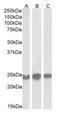 Chromobox 5 antibody, orb19140, Biorbyt, Western Blot image 