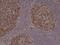 Stathmin 1 antibody, M01194-1, Boster Biological Technology, Immunohistochemistry paraffin image 