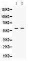 Src Kinase Associated Phosphoprotein 1 antibody, PB9890, Boster Biological Technology, Western Blot image 