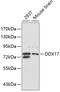 DEAD-Box Helicase 17 antibody, 19-958, ProSci, Western Blot image 