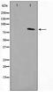 Transforming Acidic Coiled-Coil Containing Protein 1 antibody, TA347607, Origene, Western Blot image 