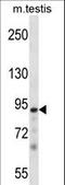 Protein Kinase N3 antibody, LS-C164538, Lifespan Biosciences, Western Blot image 