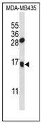 Granulysin antibody, AP51884PU-N, Origene, Western Blot image 