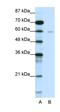 A-Kinase Anchoring Protein 9 antibody, orb330004, Biorbyt, Western Blot image 