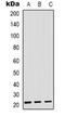 Secretion Associated Ras Related GTPase 1B antibody, orb318816, Biorbyt, Western Blot image 