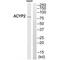 ATP Binding Cassette Subfamily B Member 7 antibody, A06088, Boster Biological Technology, Western Blot image 