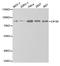 Eukaryotic Translation Initiation Factor 4B antibody, LS-C334046, Lifespan Biosciences, Western Blot image 