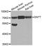 DNA Nucleotidylexotransferase antibody, STJ28010, St John