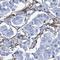 Phosphoglucomutase-2 antibody, NBP2-32601, Novus Biologicals, Immunohistochemistry frozen image 