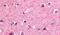 Nuclear Receptor Subfamily 4 Group A Member 3 antibody, PA5-34011, Invitrogen Antibodies, Immunohistochemistry paraffin image 