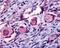 Nuclear Receptor Subfamily 4 Group A Member 1 antibody, 48-174, ProSci, Immunohistochemistry paraffin image 