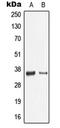 Galectin 9 antibody, LS-C352462, Lifespan Biosciences, Western Blot image 