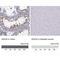 DEAD-Box Helicase 20 antibody, NBP1-84058, Novus Biologicals, Immunohistochemistry paraffin image 