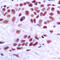 Mediator Complex Subunit 1 antibody, GTX55164, GeneTex, Immunohistochemistry paraffin image 