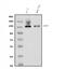 ATP Binding Cassette Subfamily B Member 1 antibody, A00049-3, Boster Biological Technology, Western Blot image 