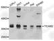 Toll Like Receptor Adaptor Molecule 2 antibody, A8292, ABclonal Technology, Western Blot image 