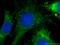 Serine Peptidase Inhibitor, Kunitz Type 1 antibody, 15036-1-AP, Proteintech Group, Immunofluorescence image 