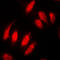 DNA Topoisomerase II Alpha antibody, LS-B16084, Lifespan Biosciences, Immunofluorescence image 