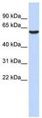 Gamma-Aminobutyric Acid Type A Receptor Beta3 Subunit antibody, TA338701, Origene, Western Blot image 