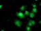 Dual Specificity Phosphatase And Pro Isomerase Domain Containing 1 antibody, M14857, Boster Biological Technology, Immunofluorescence image 