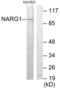 N(Alpha)-Acetyltransferase 15, NatA Auxiliary Subunit antibody, abx013778, Abbexa, Western Blot image 