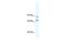 DEAD-Box Helicase 42 antibody, GTX47520, GeneTex, Western Blot image 