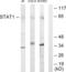 Signal transducer and activator of transcription 1-alpha/beta antibody, abx013486, Abbexa, Western Blot image 