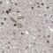 ALC1 antibody, PA5-55689, Invitrogen Antibodies, Immunohistochemistry frozen image 