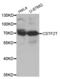 Cleavage Stimulation Factor Subunit 2 Tau Variant antibody, abx003405, Abbexa, Western Blot image 