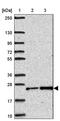 Collagen Triple Helix Repeat Containing 1 antibody, PA5-63777, Invitrogen Antibodies, Western Blot image 