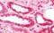 Ferrochelatase, mitochondrial antibody, MBS248045, MyBioSource, Immunohistochemistry frozen image 