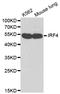 Interferon Regulatory Factor 4 antibody, STJ24229, St John