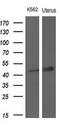 TNF Receptor Superfamily Member 10a antibody, M02152-1, Boster Biological Technology, Western Blot image 