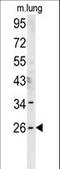 DnaJ Heat Shock Protein Family (Hsp40) Member C8 antibody, LS-C167487, Lifespan Biosciences, Western Blot image 