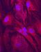Clathrin Heavy Chain Like 1 antibody, PA5-47886, Invitrogen Antibodies, Immunocytochemistry image 
