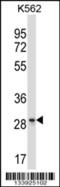 Leukocyte Associated Immunoglobulin Like Receptor 1 antibody, 57-270, ProSci, Western Blot image 